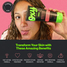 Load image into Gallery viewer, The Hero to Defeat Stubborn Acne – Oxy® Maximum Strength Acne Cream Cleanser